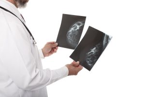 Resultados de mamografia